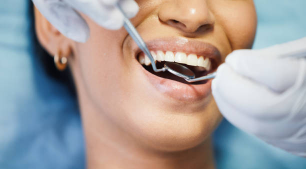 Best Emergency Root Canal Treatment in Beardstown, IL